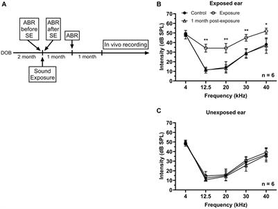 Depolarization shift in the resting membrane potential of inferior colliculus neurons explains their hyperactivity induced by an acoustic trauma